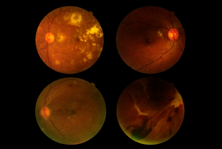 Dixit Netra Chikitsalaya